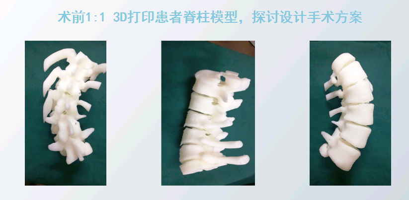 上海數造攜手安徽省二院骨三科專家章玉冰主任 開展3D打印醫療骨科應用在線講堂