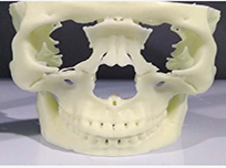 術前指導模型-面部骨骼創傷修復